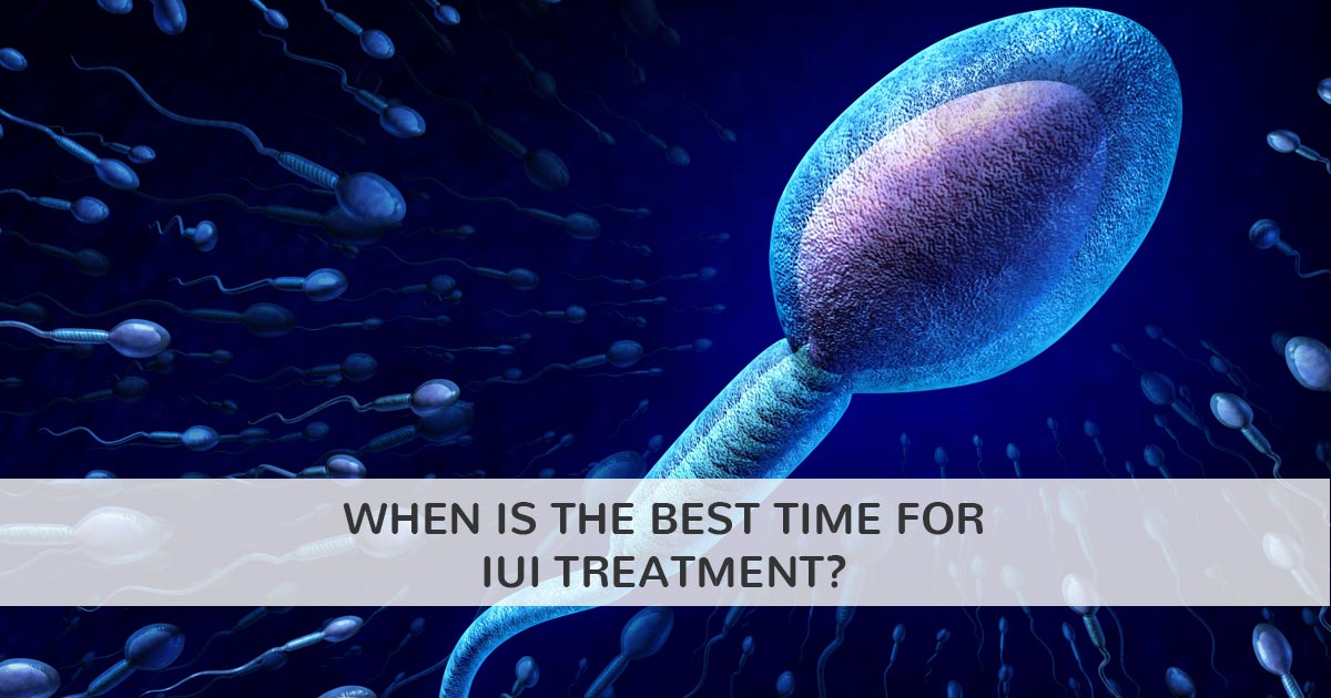 Best Time for IUI: When is the Best Time for IUI treatment?