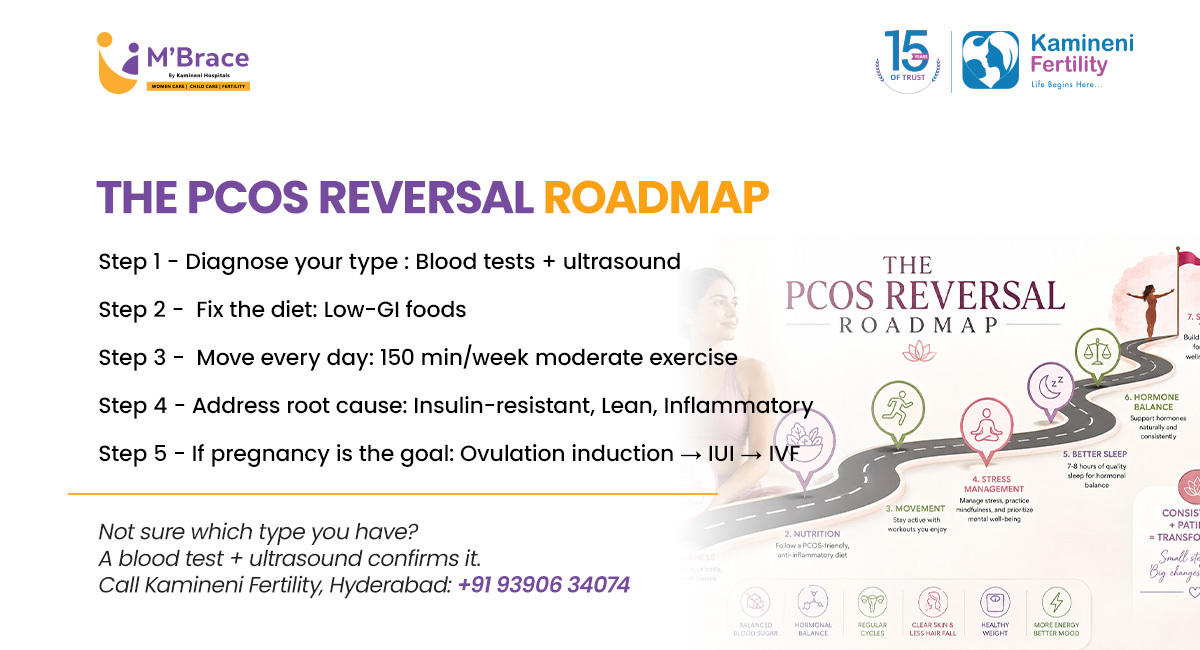 How to Cure PCOS Permanently