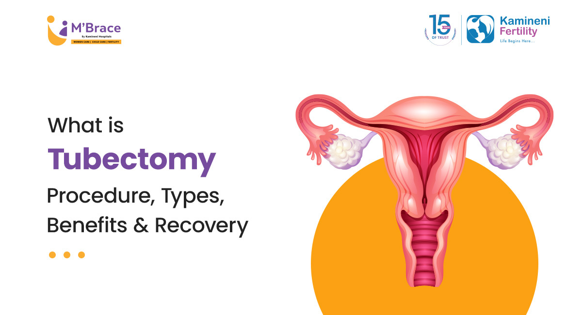 What Is Tubectomy: Procedure